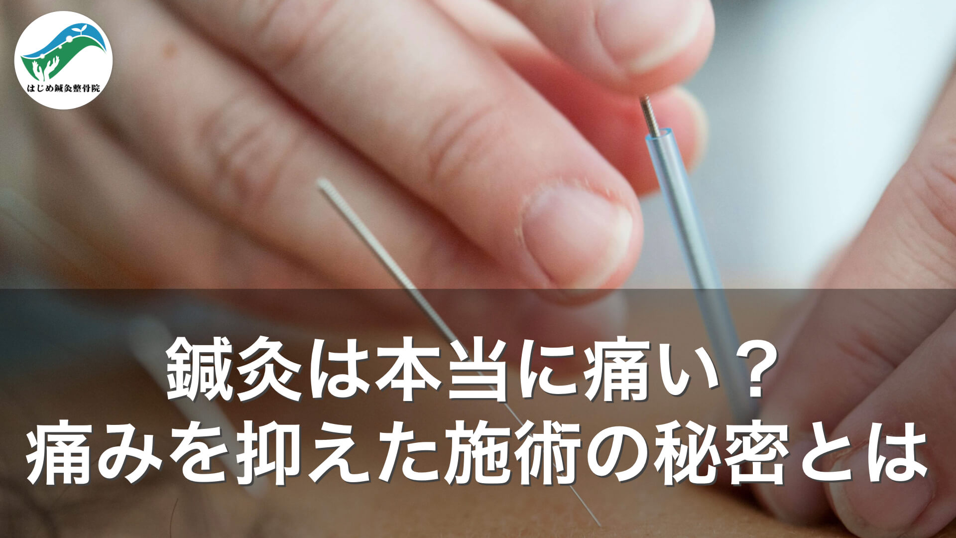 鍼灸は本当に痛い？痛みを抑えた施術の秘密とは｜旭川市のはじめ鍼灸整骨院